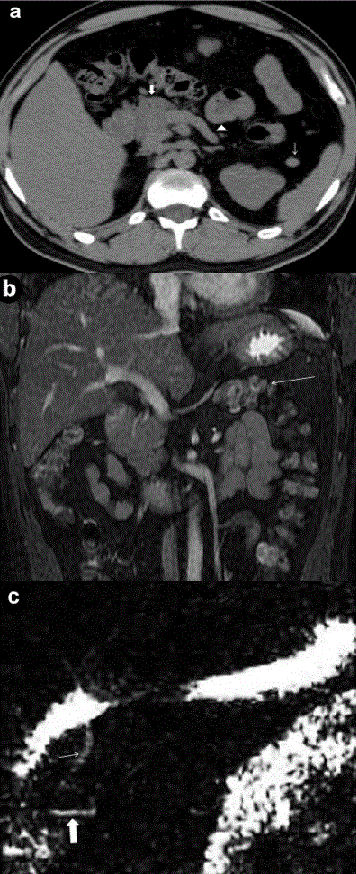 tomography