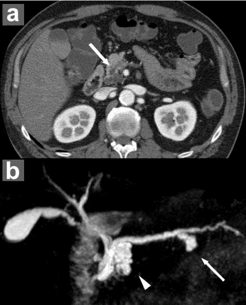 Preoperative