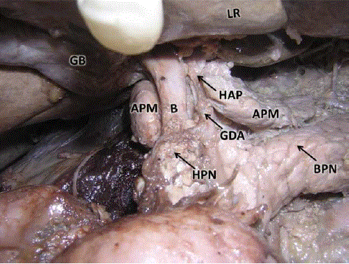 pancreatic