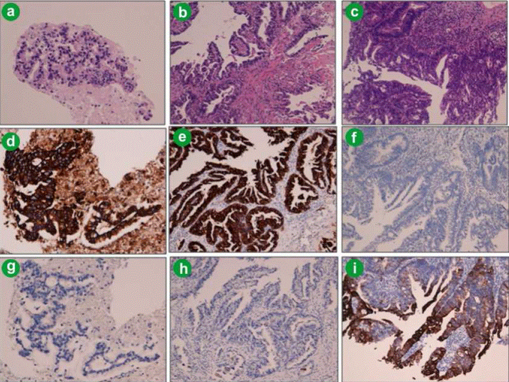 pancreatic