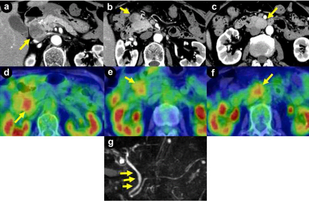 tomography