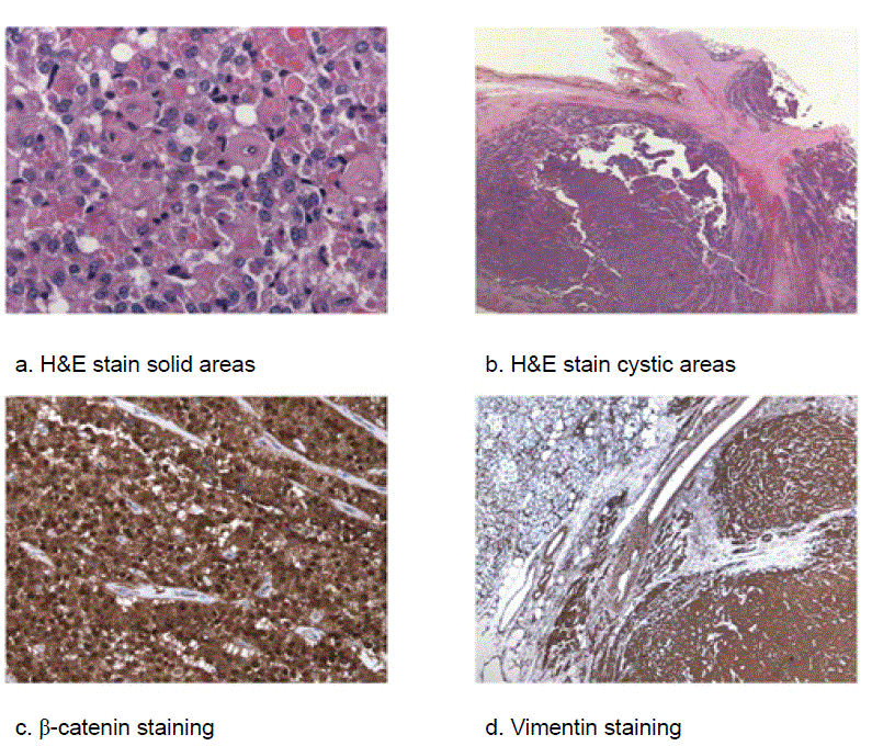 Histopathology