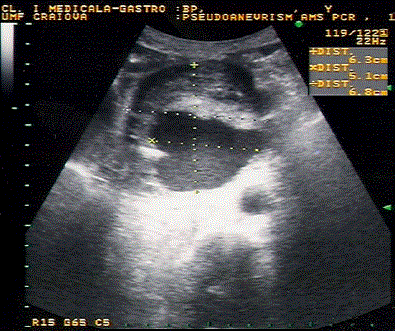 ultrasound