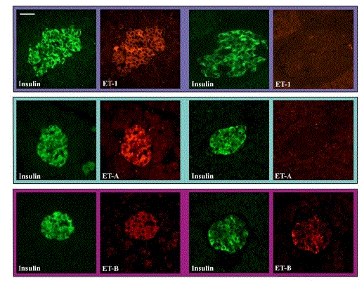 Immunohistochemical