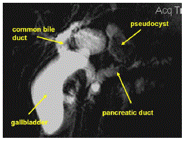 pancreatic
