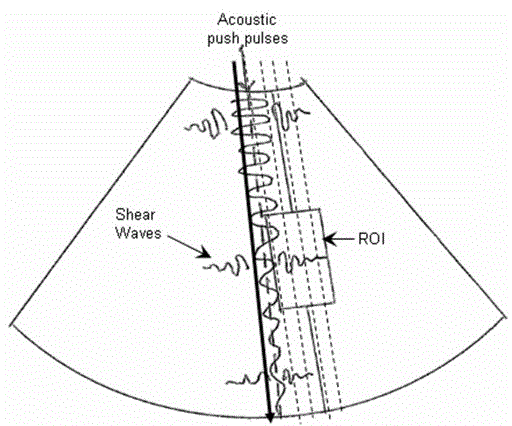 quantification