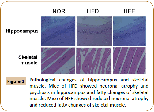 Physiotherapy-hippocampus