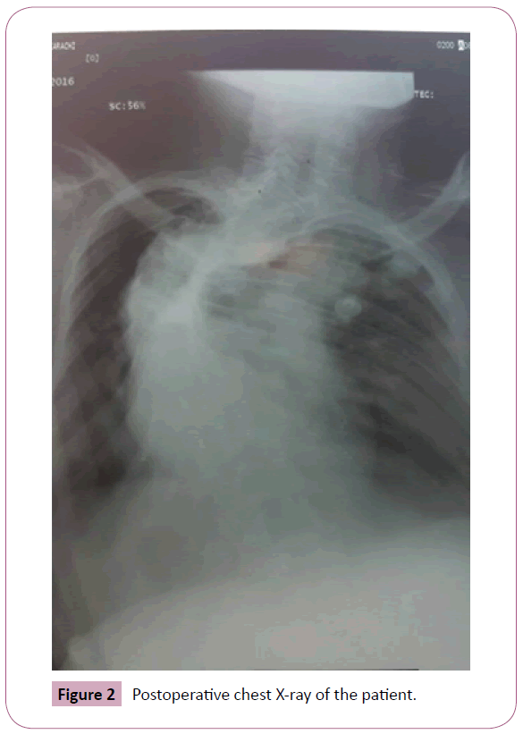 anaesthesia-painmedicine-X-ray-patient