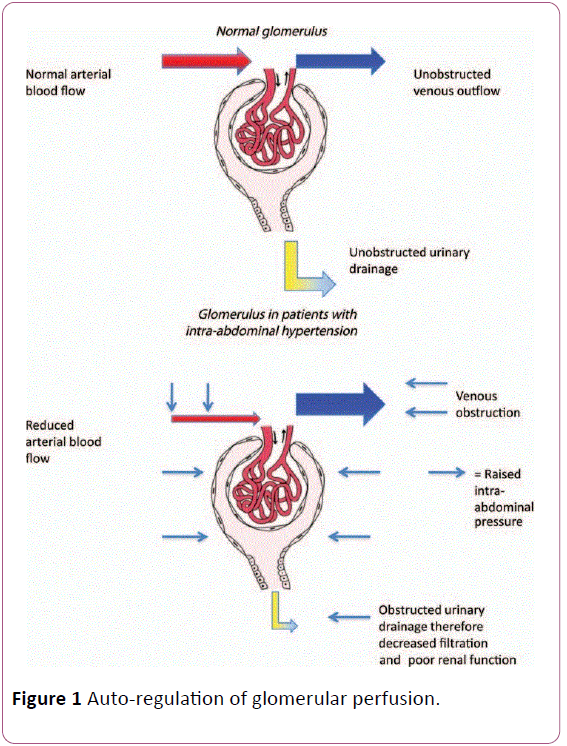 anaesthesiology-critical-Auto-regulation