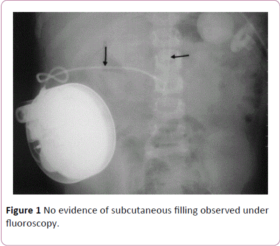 anaesthesiology-critical-subcutaneous-filling