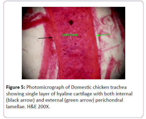 anatomical-science-research-hyaline-cartilage