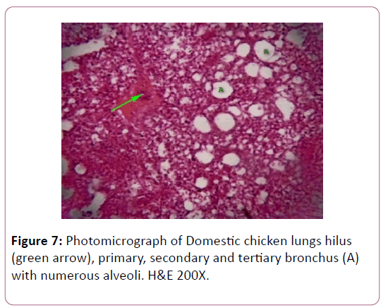 anatomical-science-research-tertiary-bronchus