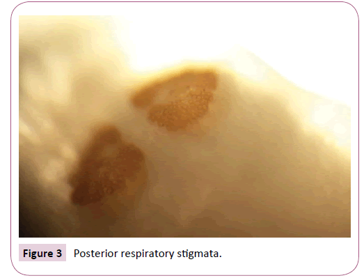 https://www.imedpub.com/articles-images/applied-microbiology-and-biochemistry-stigmata-2-1-5-g003.png