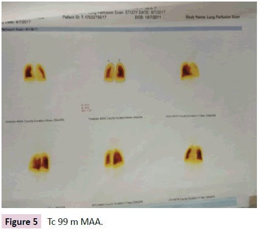 birth-defects-Tc-99m-MAA