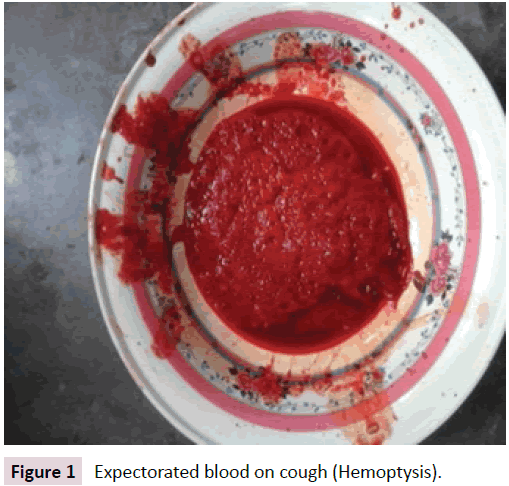 birth-defects-blood-cough