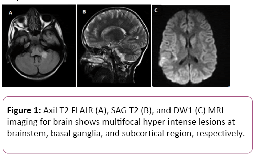 brain-behaviour-and-cognitive-sciences-multifocal