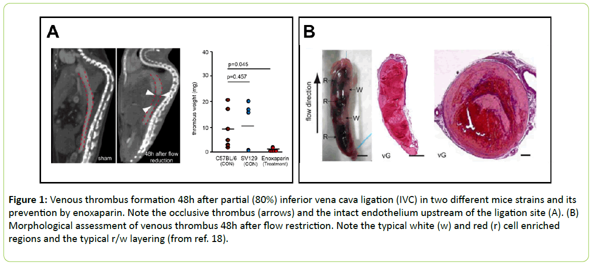 british-biomedical-Venous-thrombus-formation