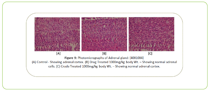 british-biomedical-bulletin-Photomicrographs-of-Adrenal-gland