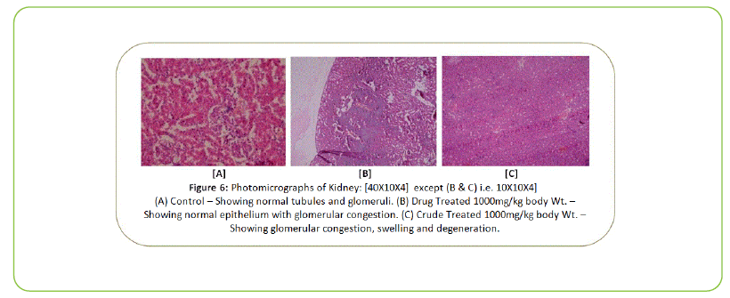 british-biomedical-bulletin-Photomicrographs-of-Kidney