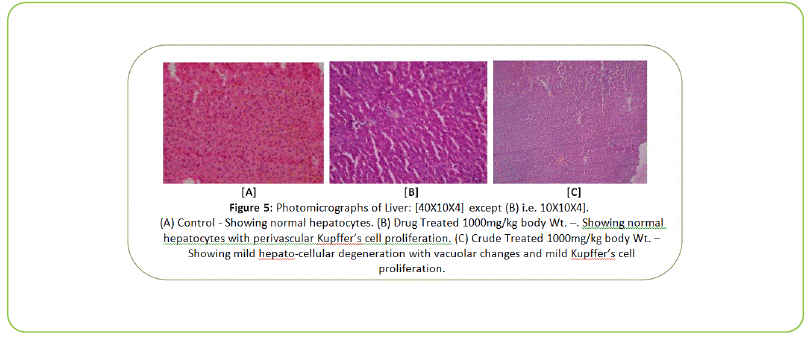 british-biomedical-bulletin-Photomicrographs-of-Liver