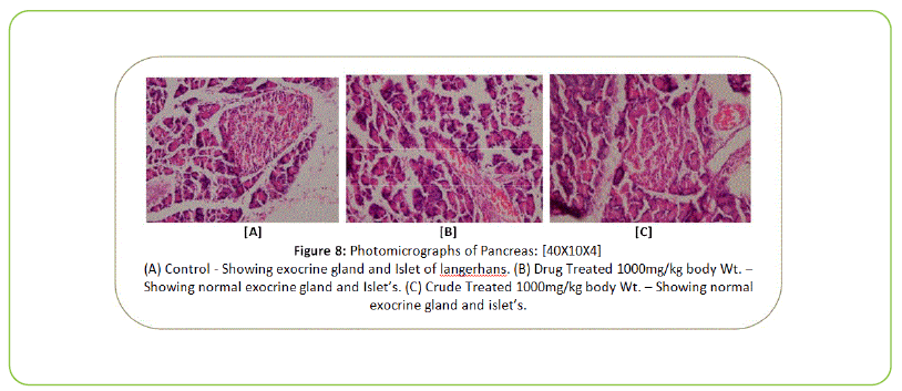 british-biomedical-bulletin-Photomicrographs-of-Pancreas