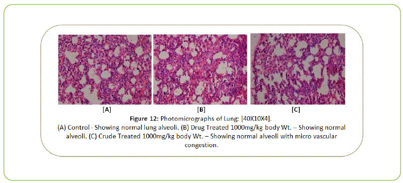 british-biomedical-bulletin-Photomicrographs-of-lung