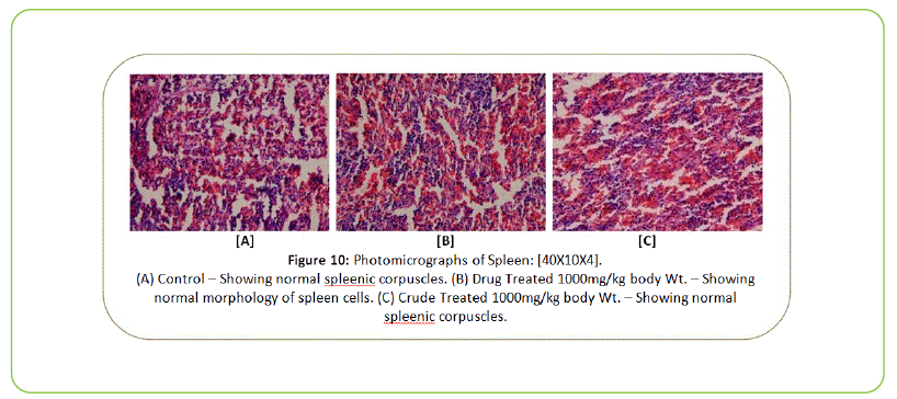 british-biomedical-bulletin-Photomicrographs-of-spleen