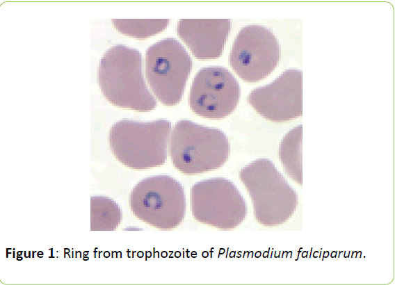 british-biomedical-bulletin-Plasmodium-falciparum