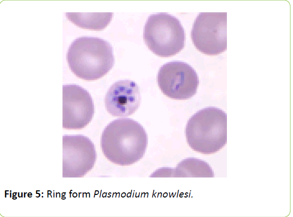 british-biomedical-bulletin-Plasmodium-knowlesi