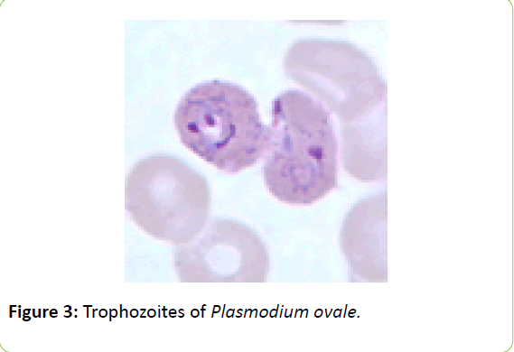 british-biomedical-bulletin-Plasmodium-ovale