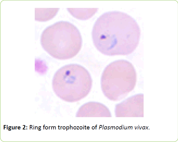 Photomicrograph of the malaria parasite Plasmodium vivax in ring form...  News Photo - Getty Images