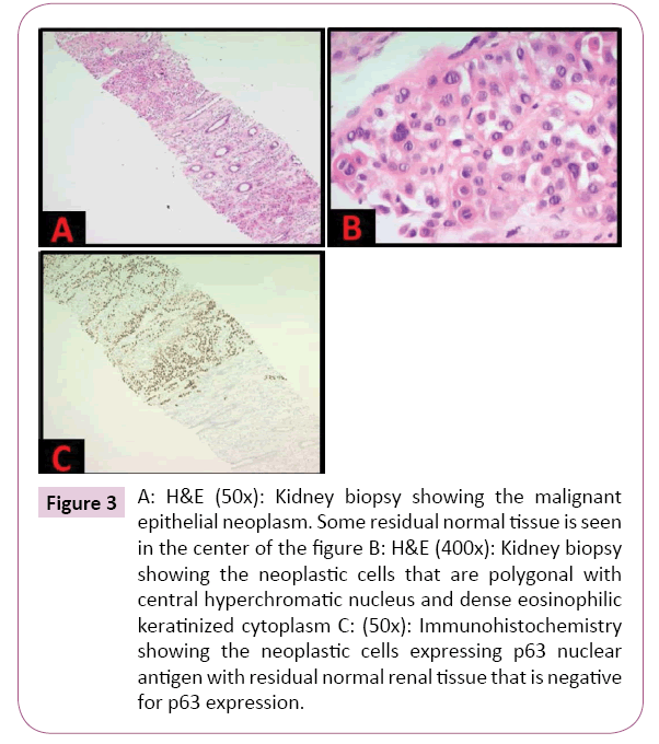 cancer-biology-and-therapeutic-oncology-epithelial