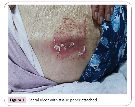 cancer-biology-and-therapeutic-oncology-ulcer