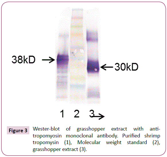 clinical-immunology-Wester-blot