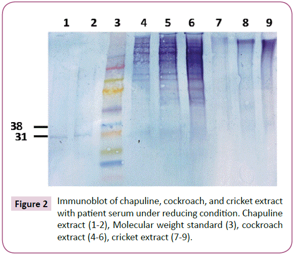 clinical-immunology-patient-serum