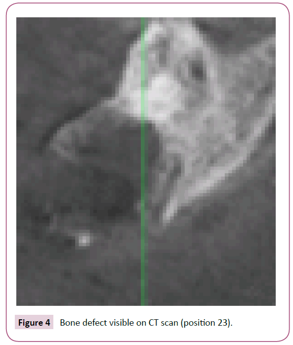 clinical-medicine-therapeutics-CT-scan