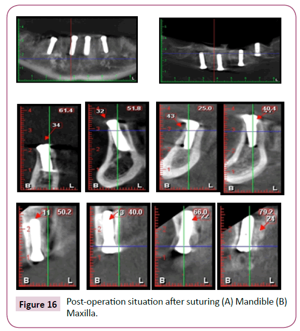 clinical-medicine-therapeutics-Mandible