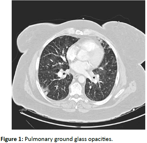 clinical-medicine-therapeutics-Pulmonary-ground