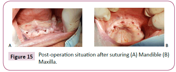 clinical-medicine-therapeutics-after-suturing