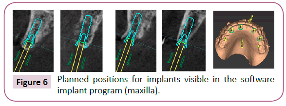 clinical-medicine-therapeutics-implant-program