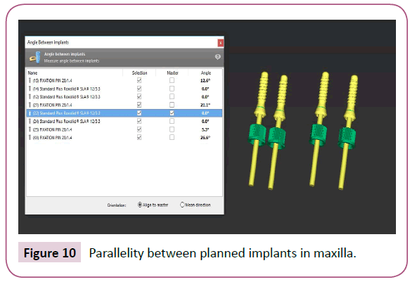 clinical-medicine-therapeutics-implants-maxilla