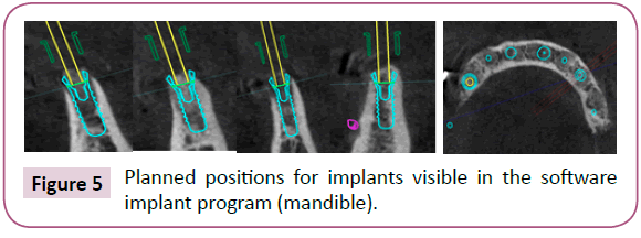 clinical-medicine-therapeutics-implants-visible