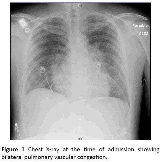 clinical-medicine-therapeutics-vascular-congestion