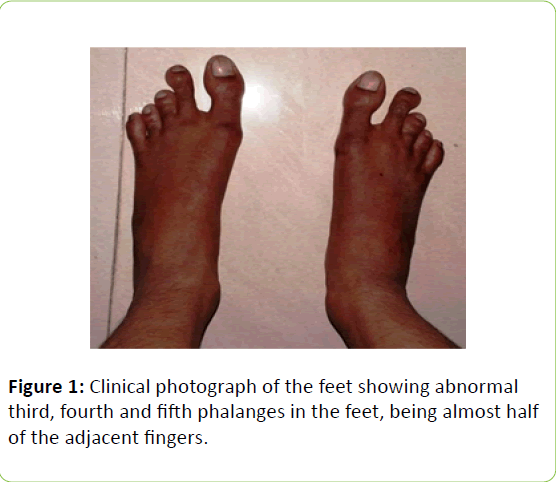 clinical-molecular-endocrinology-feet-showing