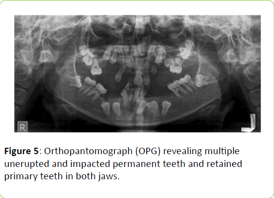 clinical-molecular-endocrinology-permanent-teeth