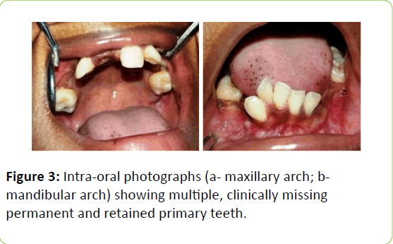 clinical-molecular-endocrinology-primary-teeth