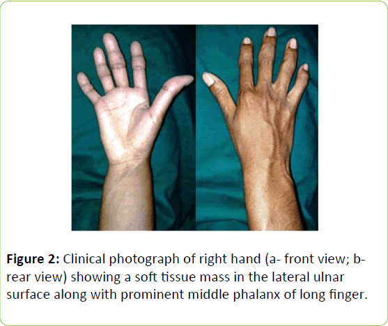 clinical-molecular-endocrinology-right-hand