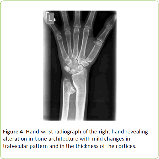 clinical-molecular-endocrinology-trabecular-pattern