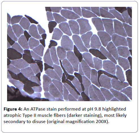 clinical-molecular-pathology-ATPase-stain-performed