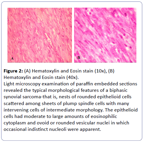 clinical-molecular-pathology-Eosin-stain